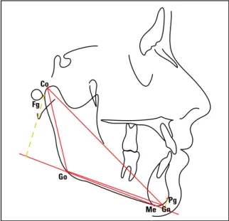 FIGURE 1 - Demarcation of anatomical landmarks and linear measurements.