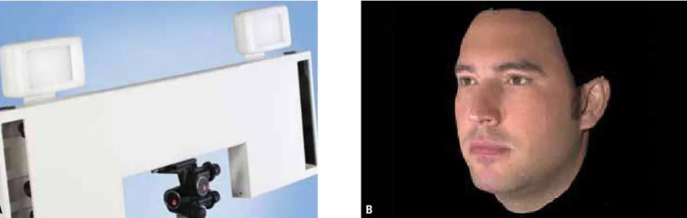 FIGURA 2 -  A ) Sistema Vectra-3D, CanfieldScientific, Inc., Fairfield, NJ, EUA.  B ) Imagem da face obtida através do sistema de estereofotogrametria.