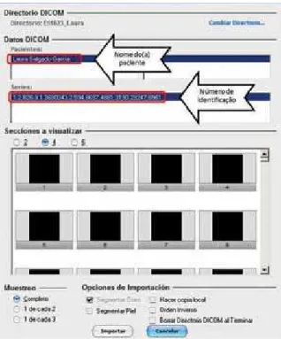 FIGURE  2  -  Window  of  the  Nemoscan  software  in  which  each  of  the  original axial sections from the CT scan can be viewed, so they can be  imported and manipulated using the software