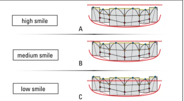FIGURE 17 - High smile ( A ); medium smile ( B ); low smile ( C ).