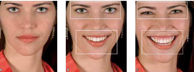 FIGURE 16 - Resting position ( A ). First stage of the smile – Social smile ( B ). Second stage of the smile – Spontaneous smile
