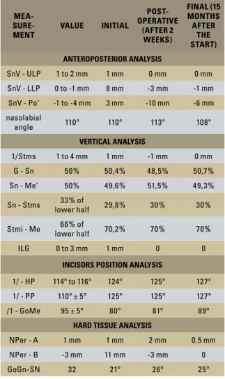 TABLE  1  -  Pretreatment,  post-operative  and  final  cephalometric  mea- mea-surements.