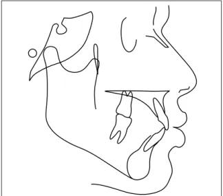 FIGURE 5 - Tracing of anatomical structures.