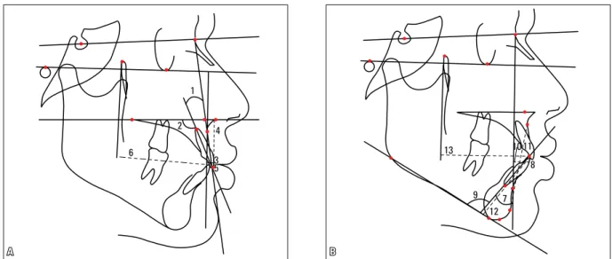 FIGURE 6 - Tracing of anatomical structures A) Maxillary anterior dentoalveolar component
