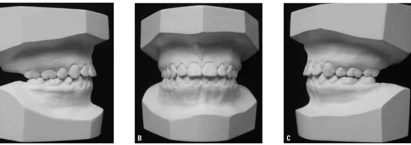 FIGURE 8 - Photographs of final dental casts. 