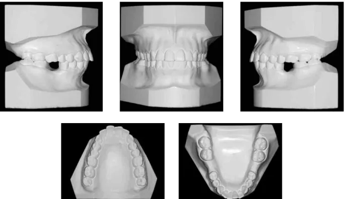 FIGURE 2 - Initial models.