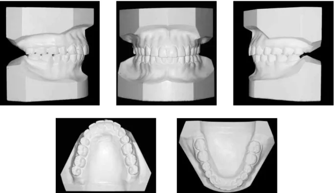 FIGURE 6 - Final models.