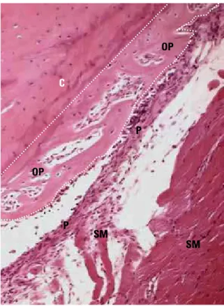 FIGURE 1 - On the bone cortical surface (CS) periosteum reveals numer- numer-ous bone cells in nature, particularly osteoblast and reserve cells with  great osteogenic potential