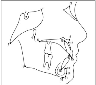 FIGURE 1 - Selected cephalometric landmarks.