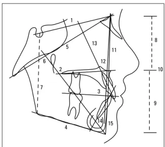 FIGURE 2 - Selected cephalometric measurements.