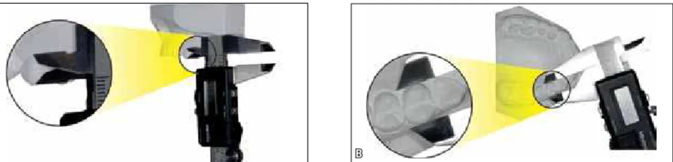 FIGURE 3 - Mesiodistal measurement of a first upper premolar using the digital caliper with a) its original tips (short) and B) the modified tips (long).