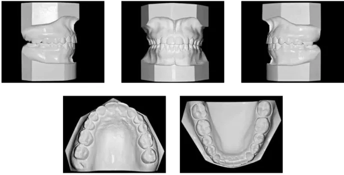 FIGURE 7 - Final panoramic (A) and periapical (B) radiographs.