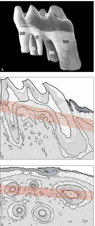 FIGURE 2 - In  A , murine first molar and its five roots. In the mesio- mesio-buccal (MB) root, forces dissipate along its larger and longer  struc-ture