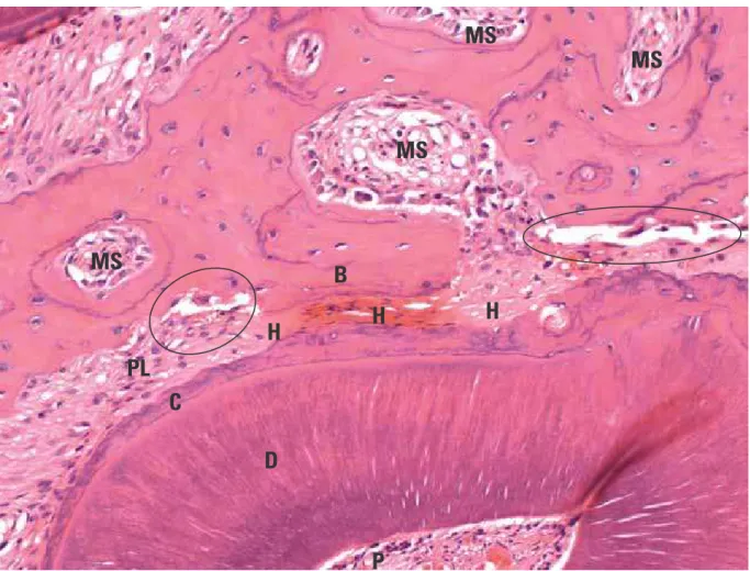 FIGURE 4 - Incipient indirect bone resorption on mesial face of murine  M1 st M distobuccal root after application of intense forces for 3 days