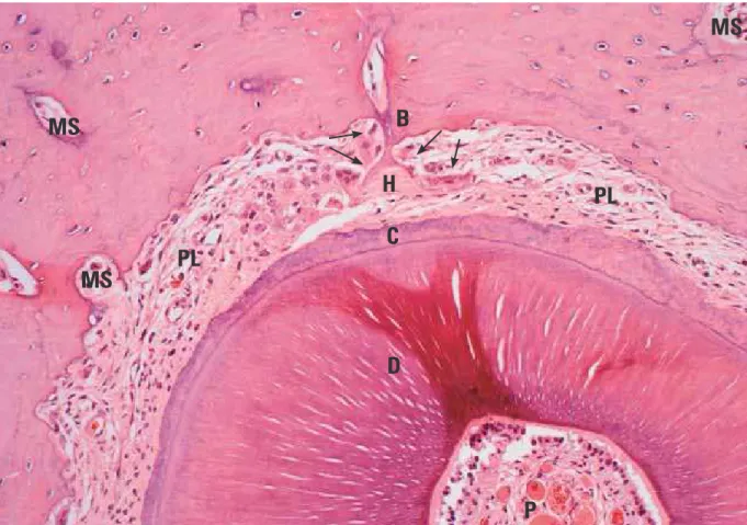 FIGURE 8 - Indirect or undermining bone resorption (arrows) on mesial face of murine M1 st M distobuccal root after application of intense forces for 9 days,  and more advanced reorganization than in Figure 7