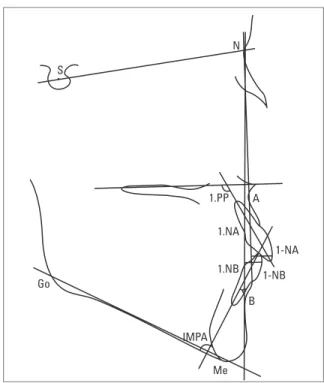 FIGURE  4  -  Cephalometric  tracing  used  to  obtain  cephalometric  mea- mea-surements in this study.