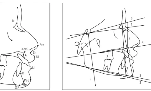 FIGURE 1 - Cephalometric points (landmarks). FIGURE 2 - Reference planes and lines.