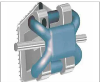 FIGURE  10  -  Slide  ligatures  (Source:  www.jco-online.com/files/