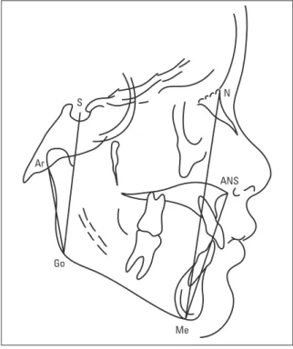 FIGURE 1 - Landmarks and lines that were used in this study.