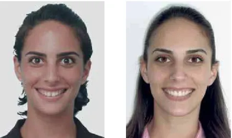 FIGURE 28 - Change in smile esthetics between initial and final phases of treatment.