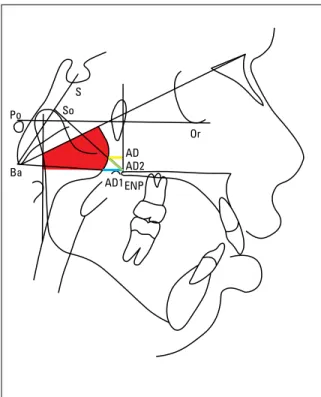 FIGURE  2  -  Diagram  describing  the  Schulhof  analysis.  The  first  factor,  in  red,  corresponds  to  the  percentage  of  the  airway  occupied  by  the  adenoid tissue in the Handelman and Osborne nasopharyngeal area; the  second factor, in blue, 
