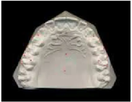 FIGURE 1 - Points marked on the digital images  of dental casts.