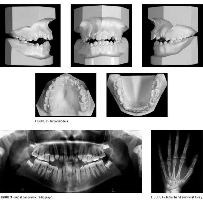 FIGURE 3 - Initial panoramic radiograph.