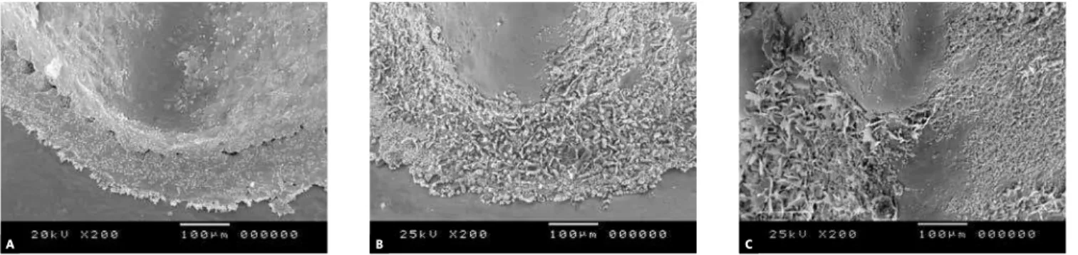 Figure 5 - Superficial aspects of the transition area between body and base of cobalt-chromium alloy brackets (magnification of 200x)