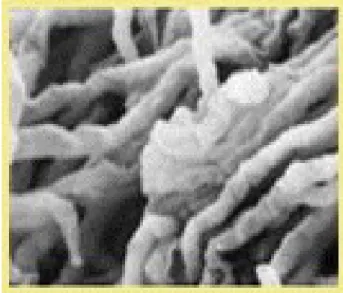 Figura 1. Microscopia de varredura da hifa (http://mycology.ivic.ve/webobjetivosi.html)