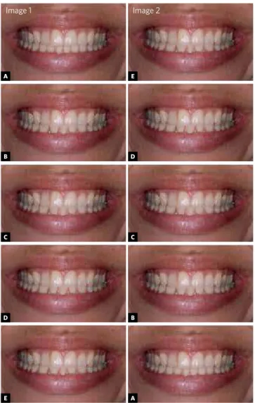 Figure 2 - Modified images assessment. Image 1: A) With four incisors; 