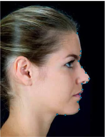 Figure 1 - Sagittal view with Interest Points (in blue) located in the fa- fa-cial profile line