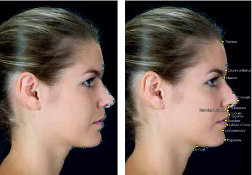 Figure 2 - Sagittal view with Interest Points (in blue) and points of anthropometric references (in yellow)  located in the facial profile line