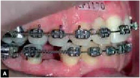 Figure 15 - Final panoramic radiograph. Figure 16 - Final lateral cephalogram.