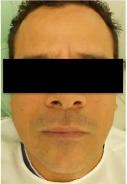 Figura 1: Aspecto facial inicial do paciente. 