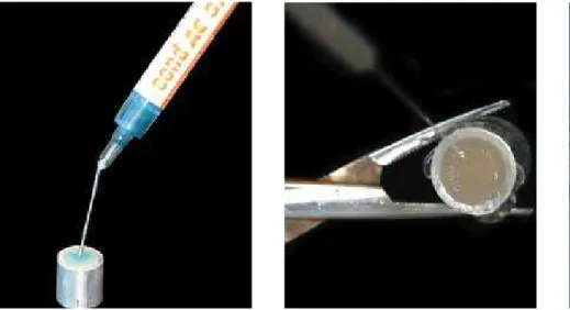 Figure 9 - Transbond ™ XT cement application and light curing with LED.