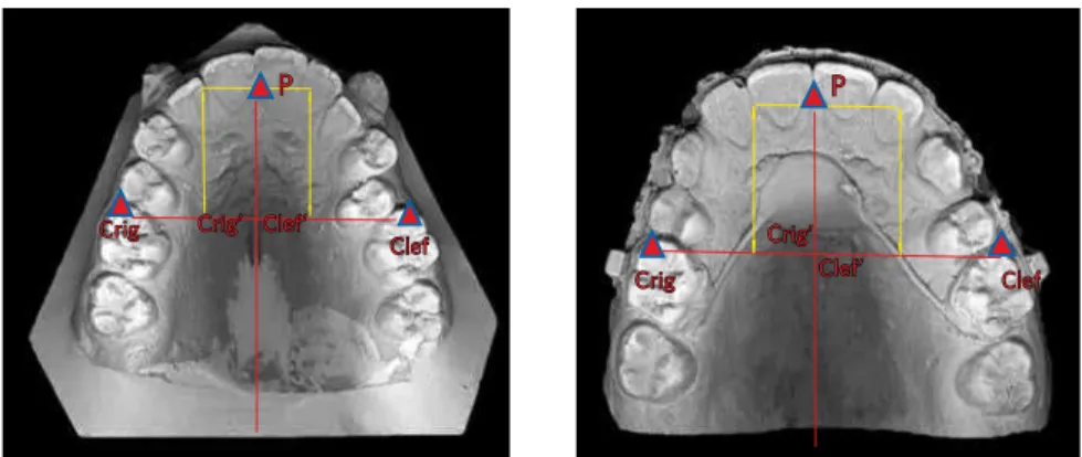 Figure 3 - Upper models (baseline and inter- inter-mediate) with lines and points traced.