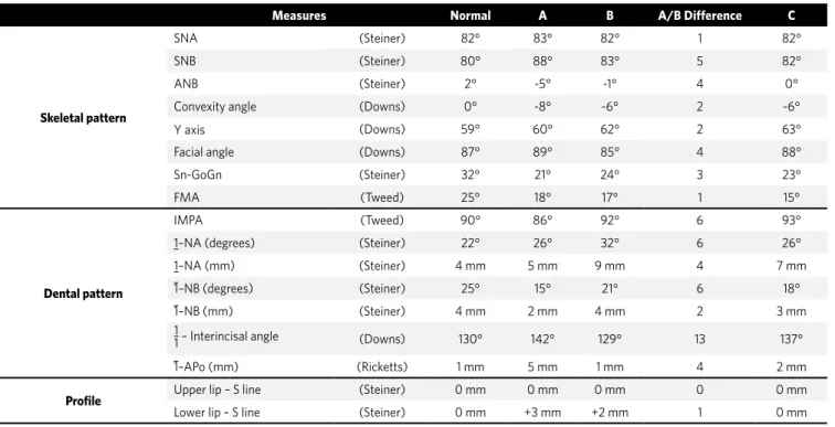 Table 2 - Intercanine and intermolar distances (mm).