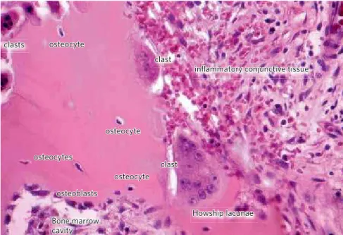 Figure 1 - The osteocyte network participates of the cellular functional control on bone surface, such as  the clasts and osteoblasts