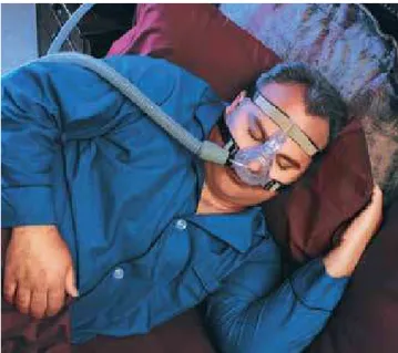 Figure 1 - Simulation of CPAP usage.