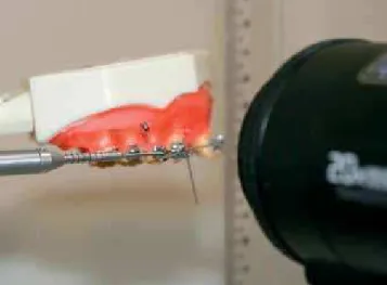 Figure 1 - Typodont in position during the canine retraction assay.