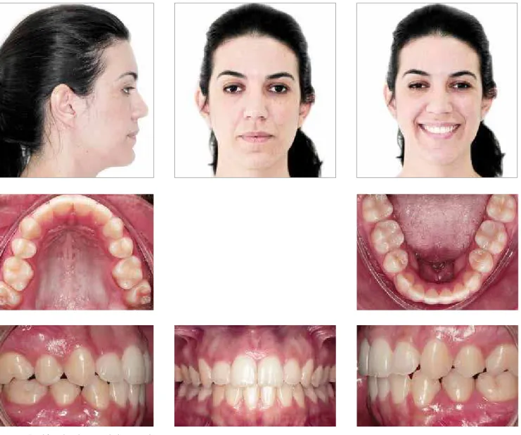 Figure 5 - Final facial and intraoral photographs.