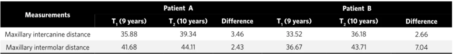 Table 2 - Transverse measures of maxillary arch obtained from study models (in millimeters).