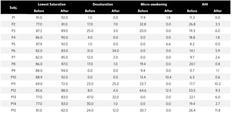 Table 4 - Oxyhemoglobin saturation index (%) and number of arousals and obstructive events per hour (AHI).