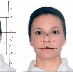 Figure 1 - Reference points used in the analyses of  the frontal facial divine proportion