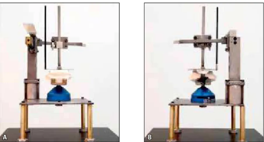 FIGURE 1 - Measuring device with models in position: frontal view (A), posterior view (B).