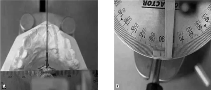 FIGURE 8 - Model positioned with the hand over the cusp of the right maxillary canine (A); protractor  pointing the position of the right maxillary canine at 33.5º (B).