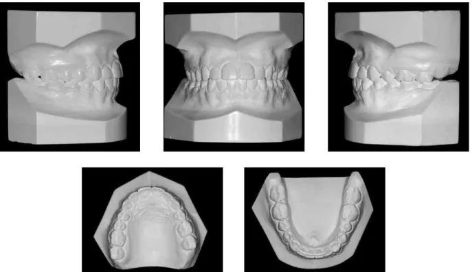 FIGURE 8 - Final dental casts.