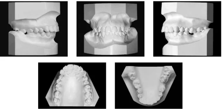 Figure 2 - Initial casts.