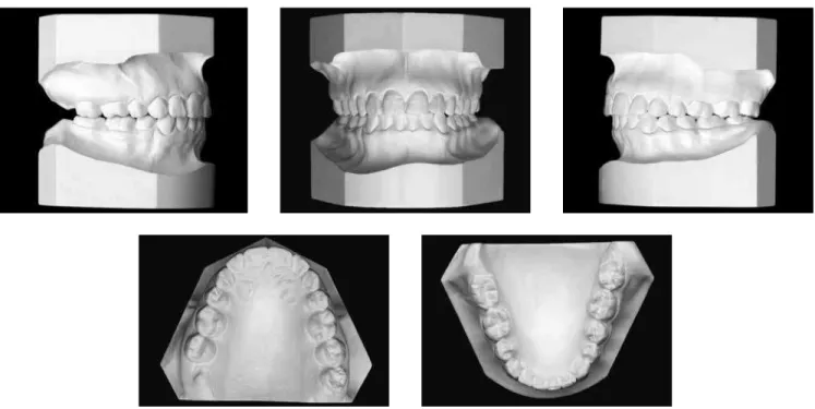 Figure 7 - Final casts.