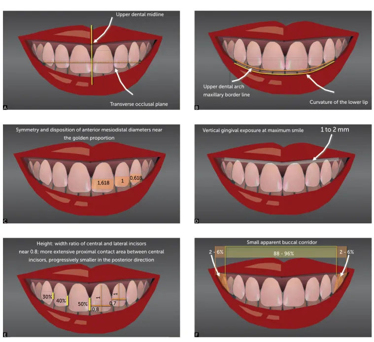 Figure 1 - Classic illustrations showing esthetic parameters for the “ideal  smile” that, despite being the ideal situation, can accept slight deviations  which can’t be noticed by our limited human perception